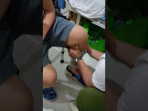 How to Put a Foot Drop Brace Splint Ankle Foot Orthosis Walking with Shoes for Stroke