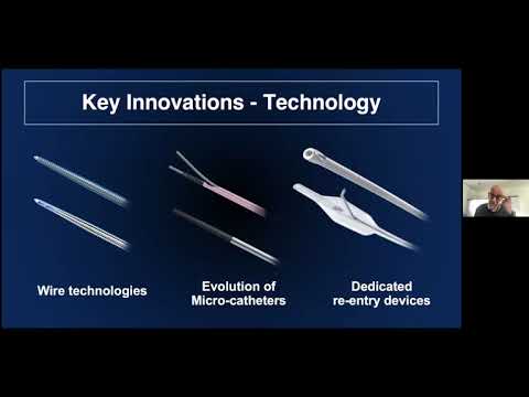 CTO: The European Perspective. Dr Elliot Smith, Barts Heart Ctr. May 12 2021