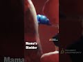 UNBELIEVABLE Fetal Movements In WOMB (Ultrasound Proof!) #pregnancy #shorts - Pregnancy and Postpartum TV UNBELIEVABLE Fetal Movements In WOMB (Ultrasound Proof!) #pregnancy #shorts