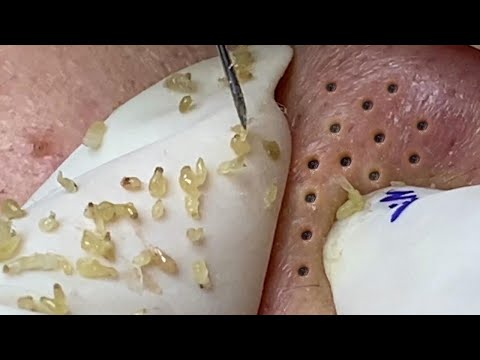 Satisfying Hien Spa Beauty Relaxing Video #31