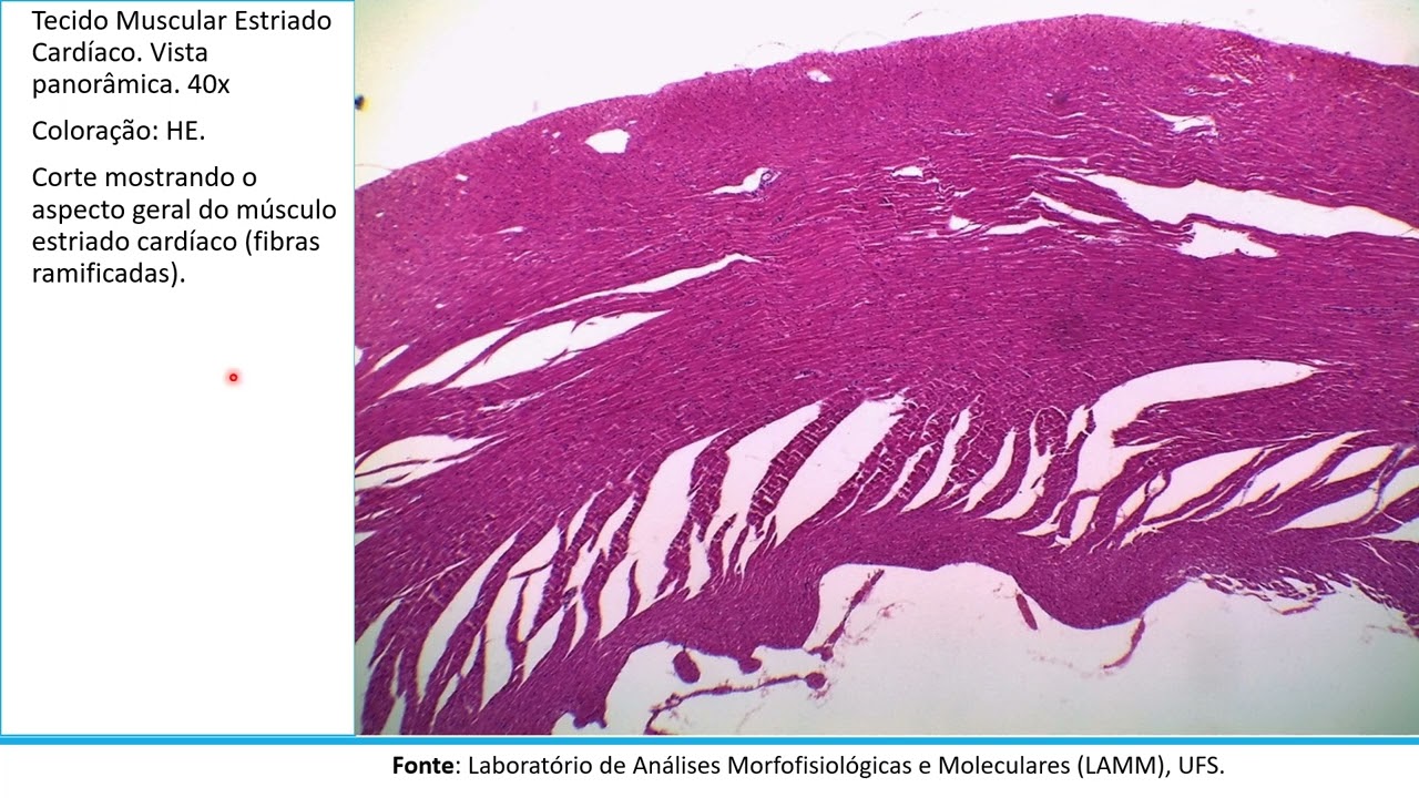 Videoatlas de Tecido Muscular