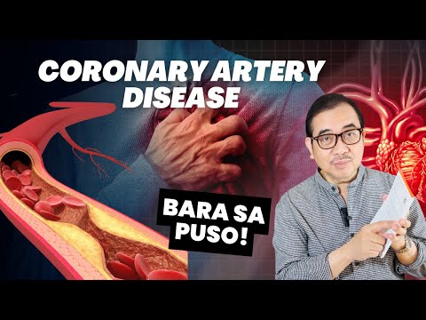 Bara sa ugat ng Puso - Coronary Artery Disease reversible ba? | DR TONY LEACHON