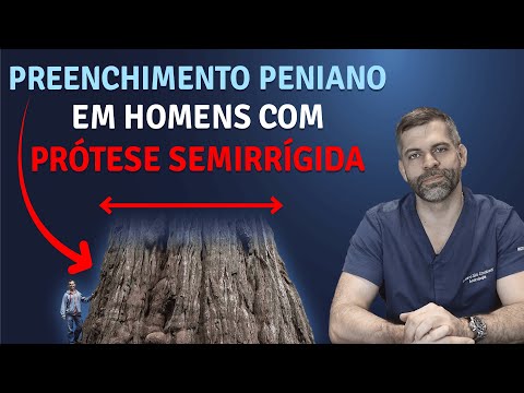 Penile augmentation in men with semi-rigid prostheses | Dr. Marco Túlio Cavalcanti