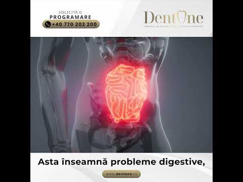 De ce trebuie înlocuiți dinții pierduți?