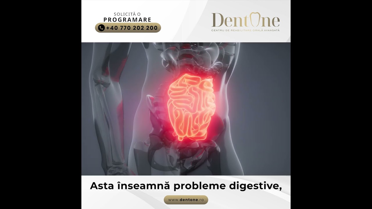 De ce trebuie înlocuiți dinții pierduți?