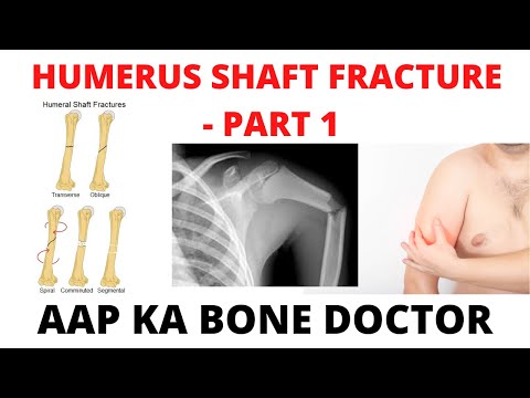 HUMERUS SHAFT FRACTURES - PART 1 - EPISODE 15