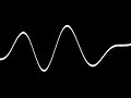 Belly Noises Active Peristalsis Noise Large Intestine
