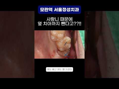 땡큐성형외과 Clips