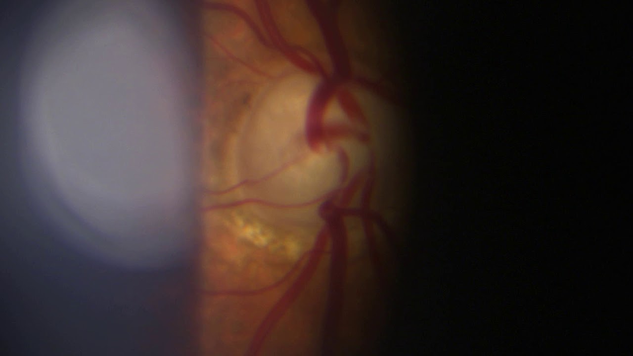 Hector Dario Forero Angel-51