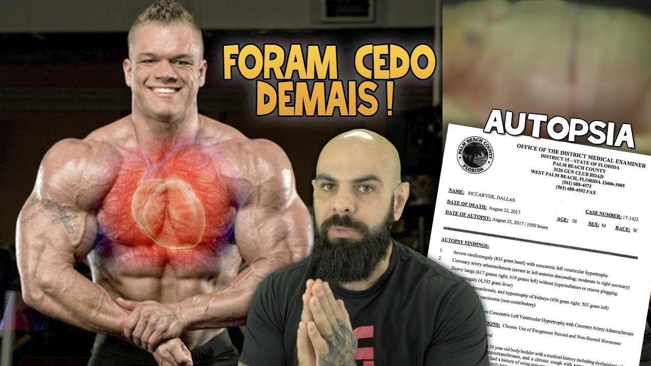 OS 6 BODYBUILDERS QUE MORRERAM CEDO DEMAIS | QUAIS FORAM AS CAUSAS?