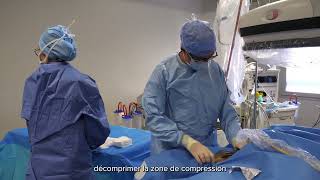 Syndrome du défilé thoraco-brachial - Hôpital privé Jean Mermoz