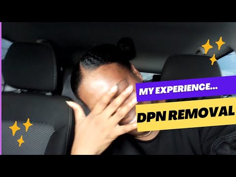 My DPN (Dermatosis Papulosa Nigra) Removal Experience - Review and Recommendations