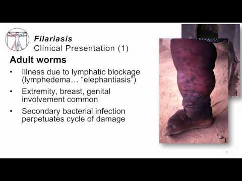 Pinworms gyermekkori tünetek fórumában