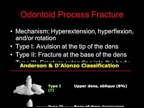 Cervical Spine Trauma
