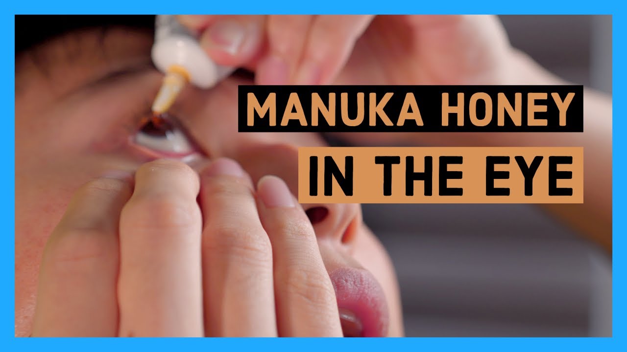 Watch video I put honey in my eyes to prove it's safe | Optimel eye gel Now I put honey in my eyes to prove it's safe | Optimel eye gel