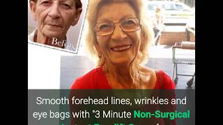 The Best Instant Facelift Cream