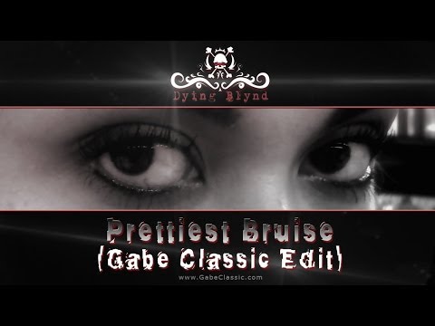 Prettiest Bruise (Gabe Classic Edit) - Dying Blynd