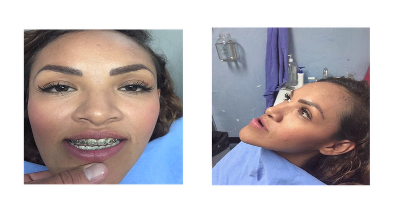 Alberto Wintergerst Fisch-43