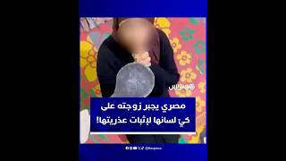 في ممارسة متخلفة ..مصري يجبر زوجته على كي لسانها لإثبات عدم كذبها بشأن عذريتها thumbnail