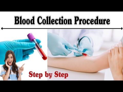 IV Cannula Colour And Size Cannula Types And Uses