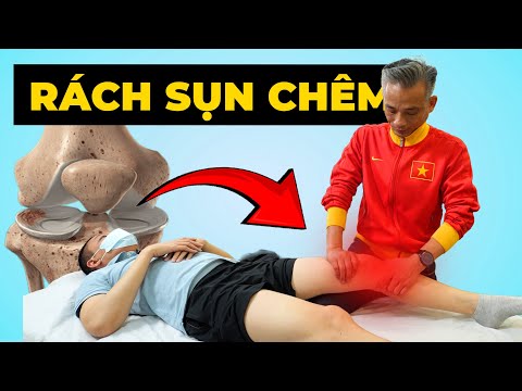 Đau Đầu Gối Khi Xoay Người? Dấu Hiệu Sụn Chêm Ngoài Tổn Thương!