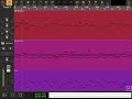 The Wonder Pets Swirling Yellow Ball Audio Evolution Cover
