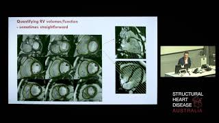 MRI of the Right Heart – Dr Imre Hunyor