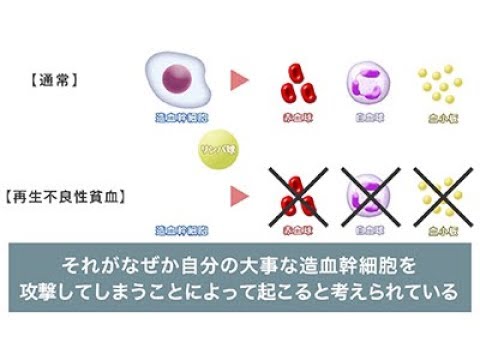 『ココカラ』Research27【早期発見がカギ！本当は恐い貧血】/金沢大学研究紹介動画