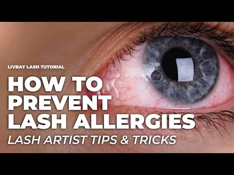 YouTube video about: How do you treat an allergic reaction to eyelash extensions?