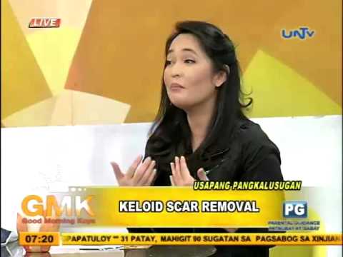 Side effect Goldline Diet menu na may pamamaga ng tiyan para sa isang linggo