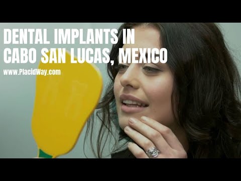 Dental Implants in Cabo San Lucas, Mexico