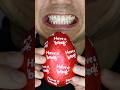 ASMR KitKat Chocolate Egg