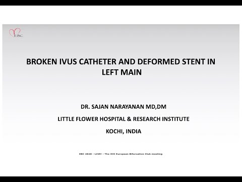 BROKEN IVUS CATHETER AND DEFORMED STENT IN LEFT MAIN - Dr SAJAN NARAYANAN