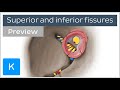 Superior and inferior orbital fissures (preview) - Human Anatomy | Kenhub