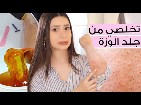أسهل طريقة للتخلص من جلد الوزة ???????? نصائح ل علاج جلد الفراولة ???? والشعر تحت الجلد | مع جوا هنا hana