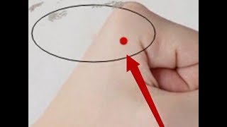 Acupressure points for suppressing cough | CCTV English