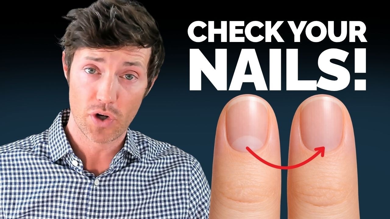 The Thyroid Nail Test That Doctors Miss