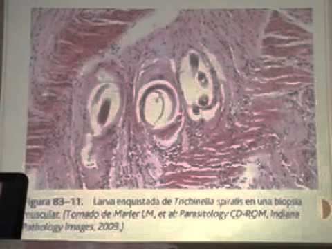 Paraziták az epevezeték diagnózisában