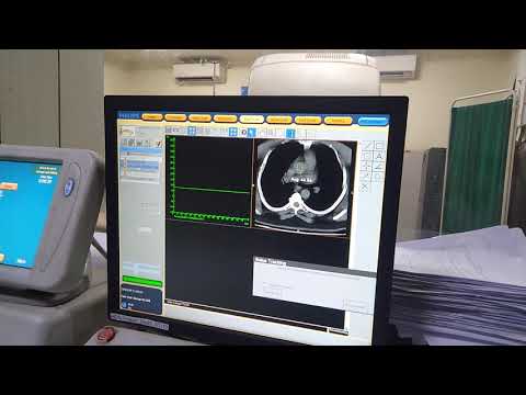 32 slice nioviz ct scanner