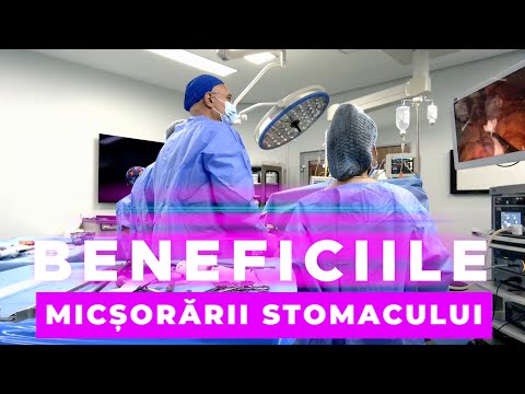 BENEFICIILE MICSORARII STOMACULUI