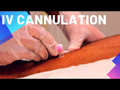 Intravenous (IV) Cannulation
