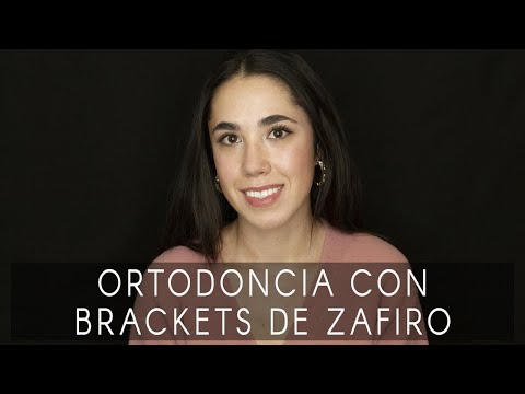 La sonrisa de Sara: brackets de zafiro