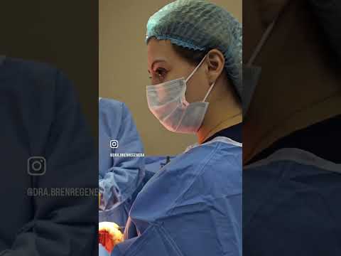 Dra. Brenda Delángel Performs Knee Surgery at NewCity Medical Plaza