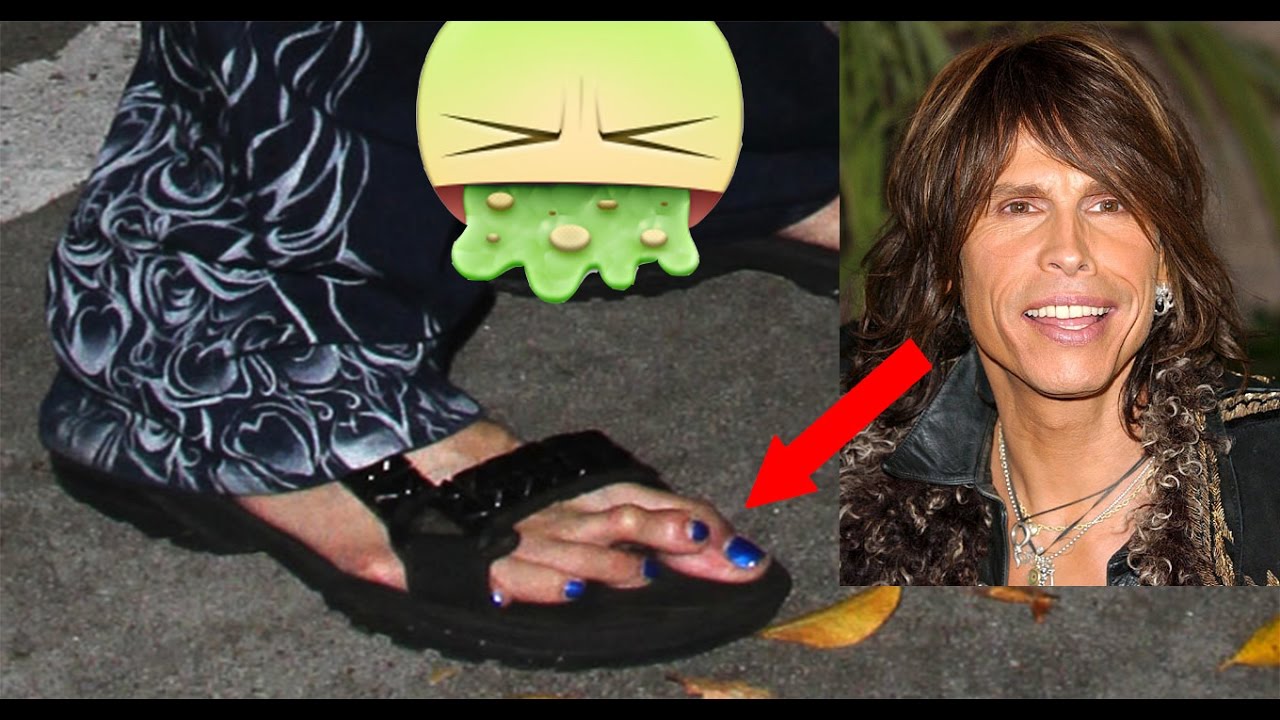 Deformities in Celebrities You Didn't Know About!