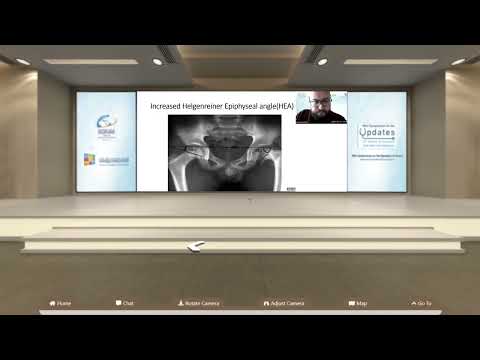 Dr.Ramy Emad eldin Shalaby _ Treatment of coxa vara using monolateral external fixator