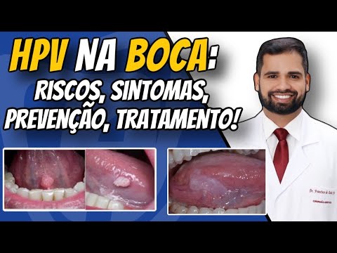 Francisco De Assis Almeida Lima Júnior-122