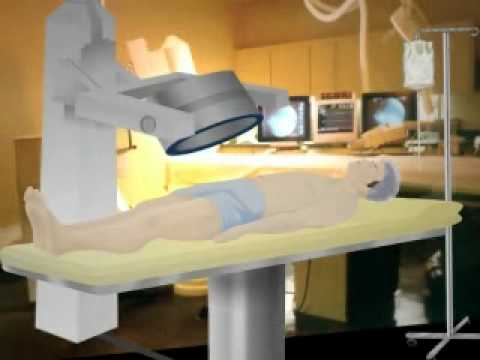 Stress Test - Drug Induced Exercise