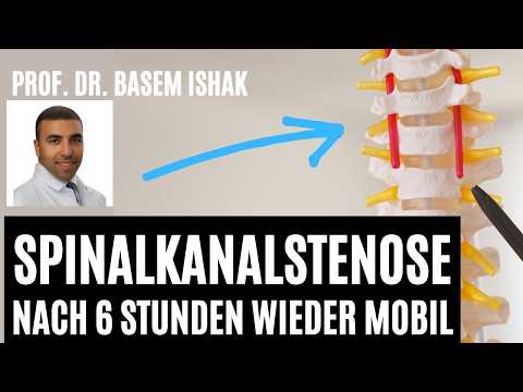 Wieder schmerzfrei trotz Spinalkanalstenose durch minimalinvasive Operation - Prof. Besam Ishak