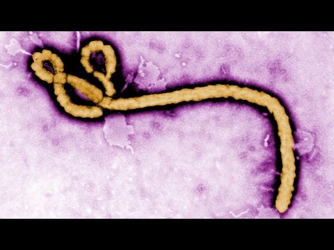 An Ebola Update From the Desk of Dr. Anthony Fauci