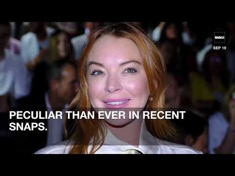 Lindsay Lohan Shocks Fans With Unrecognizable Filler-Filled Face!